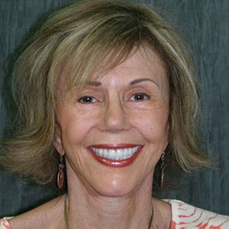 Woman with healthy smile after visiting trusted dentist in San Marcos