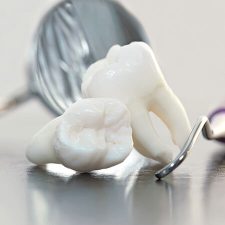 Two extracted teeth