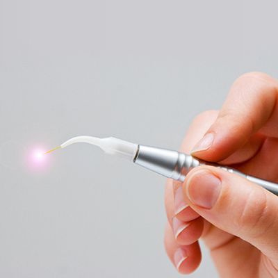 Hand holding soft tissue laser dentistry