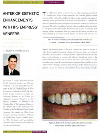Anterior Aesthetic Enhancements article in the AACD Journal magazine page summer 1998