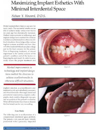 Maximizing Implant Esthetics article in the AACD Journal magazine page winter 1996