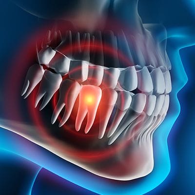 Animated smile with damaged tooth before emergency dentistry