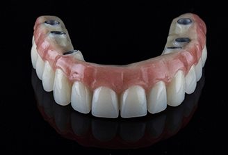 a denture made to be secured to dental implants