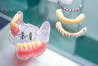 an acrylic model of a mouth with mini dental implants in it