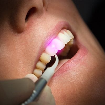 Patient receiving diode laser periodontal therpay