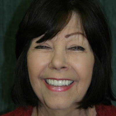Patient receiving diode laser gum disease treatment