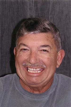 Man with unevenly spaced teeth slanted inward
