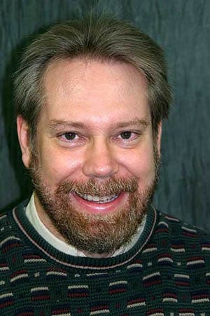 Man with yellow and dark upper teeth