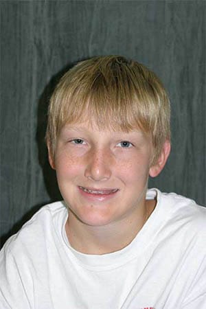 Preteen boy with few teeth