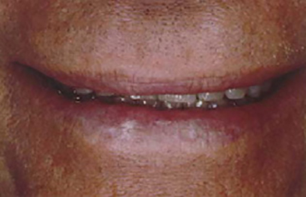 Man's smile with teeth barely visible