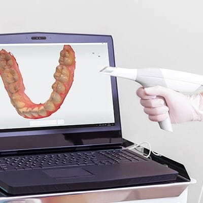 Intraoral images on chairside computer