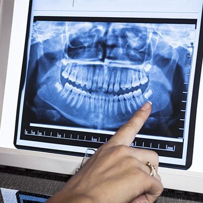 Digital x-rays on chairside computer