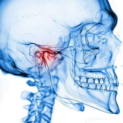 3 D x-ray of jaw and skull bone to plan TMJ therapy