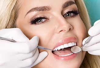 dentist color matching veneers in San Marcos