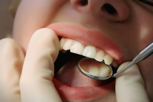 Patient visiting their San Diego dentist for a checkup