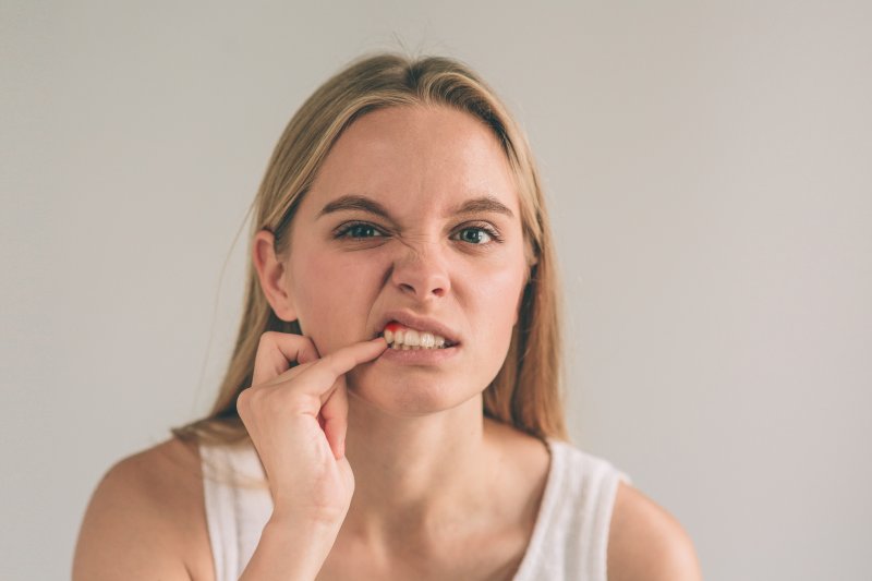 Woman with gum overgrowth