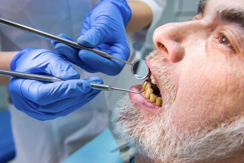 A dentist treating a patient with poor oral health in San Marcos