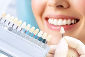 Nose to chin view of someone smiling while a dentist holds a palette of veneers up to their teeth