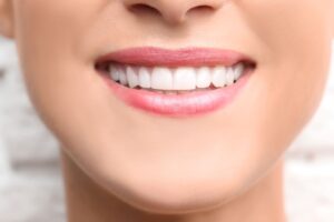 Nose-to-chin view of a woman smiling with flawless teeth
