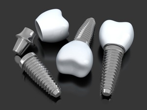 dental implants on a table